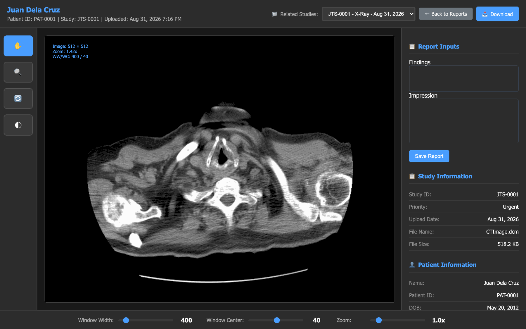 The DICOM viewer with a study open: pan / zoom / reset / window-level tools down the left, window width, window center and zoom sliders along the bottom, and a panel on the right with findings and impression boxes plus study and patient details.